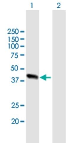 Anti-ALDOB antibody produced in mouse