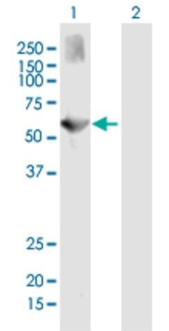 Anti-ALKBH5 antibody produced in mouse