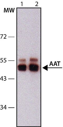 Anti-Alpha-1-Antitrypsin (AAT) antibody,Mouse monoclonal