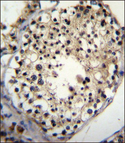 ANTI-ALKBH6 (CENTER) antibody produced in rabbit