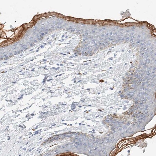 Anti-ALOX12B antibody produced in rabbit