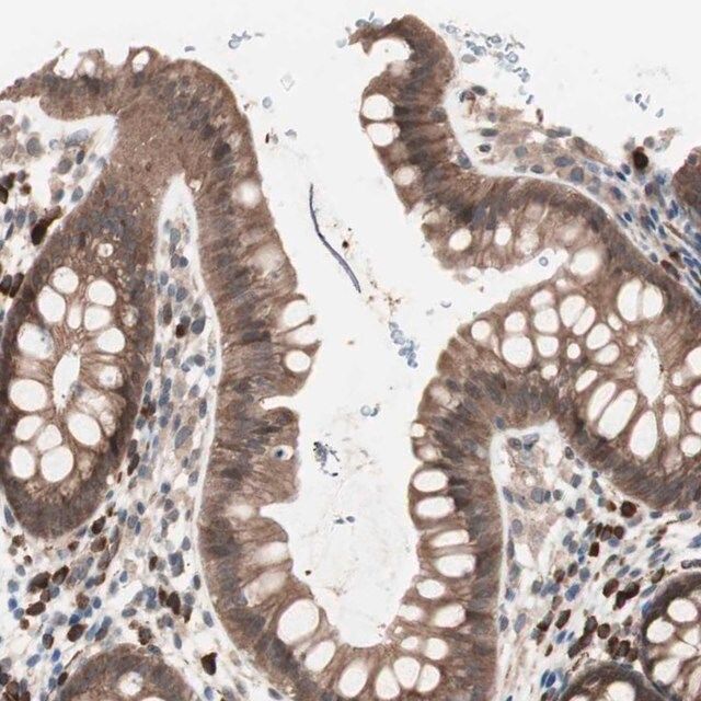 Anti-ALG5 antibody produced in rabbit