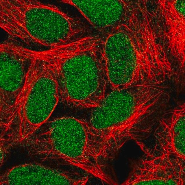 Anti-ALKBH2 antibody produced in rabbit