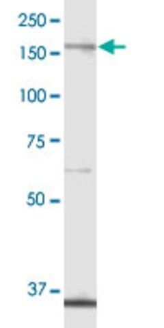 Anti-ALPK1 antibody produced in mouse