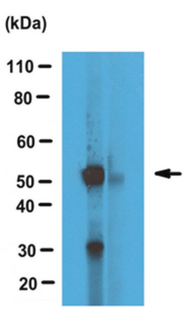 Anti-alpha Tubulin Antibody, tyrosinated