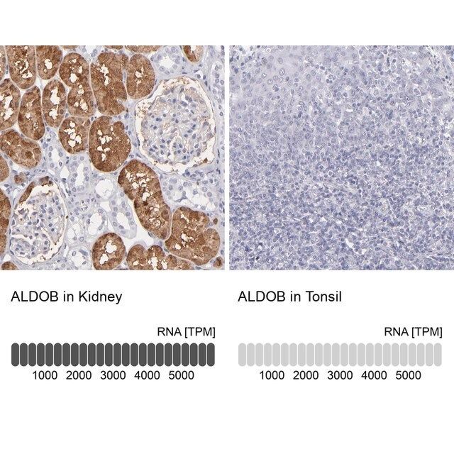 Anti-ALDOB antibody produced in rabbit