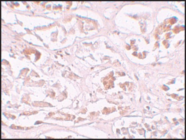 Anti-ALKBH2 antibody produced in rabbit