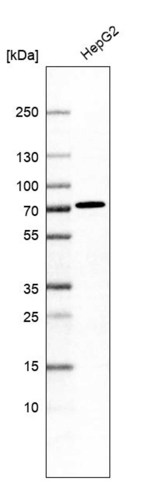 Anti-ACSS3 antibody produced in rabbit