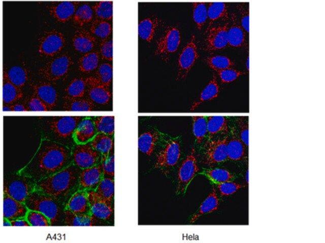 Anti-ADAM 17 Antibody