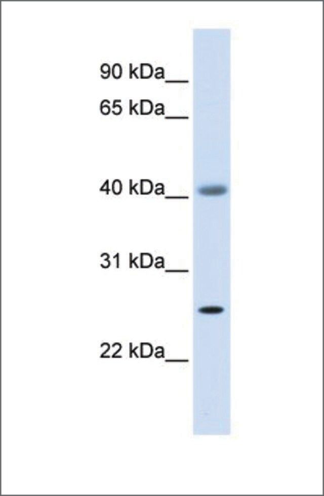 Anti-ADA antibody produced in rabbit