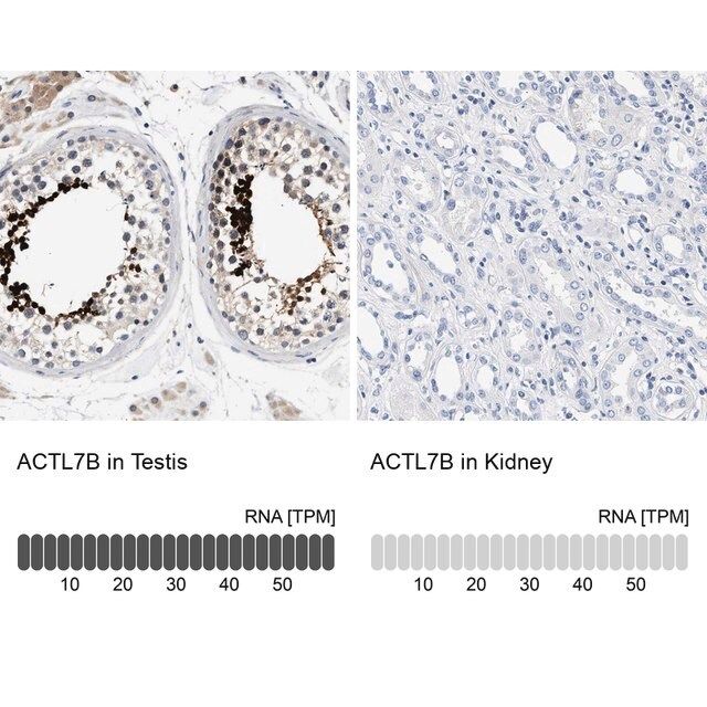 Anti-ACTL7B antibody produced in rabbit