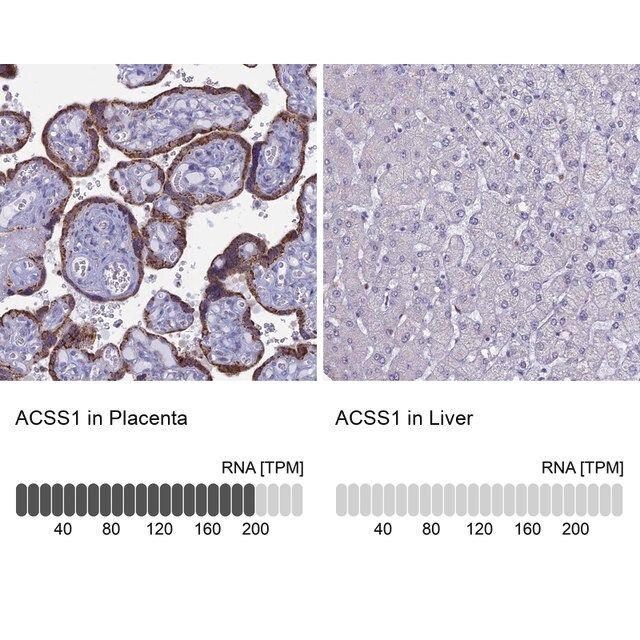 Anti-ACSS1 antibody produced in rabbit