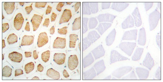 Anti-Actinin  antibody produced in rabbit