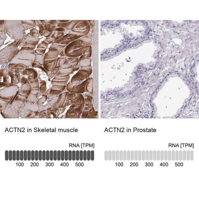 Anti-ACTN2 antibody produced in rabbit