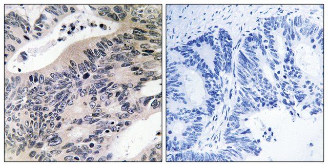 Anti-ACSS1 antibody produced in rabbit