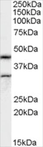 Anti-Actin-like 7B (AB2) antibody produced in goat