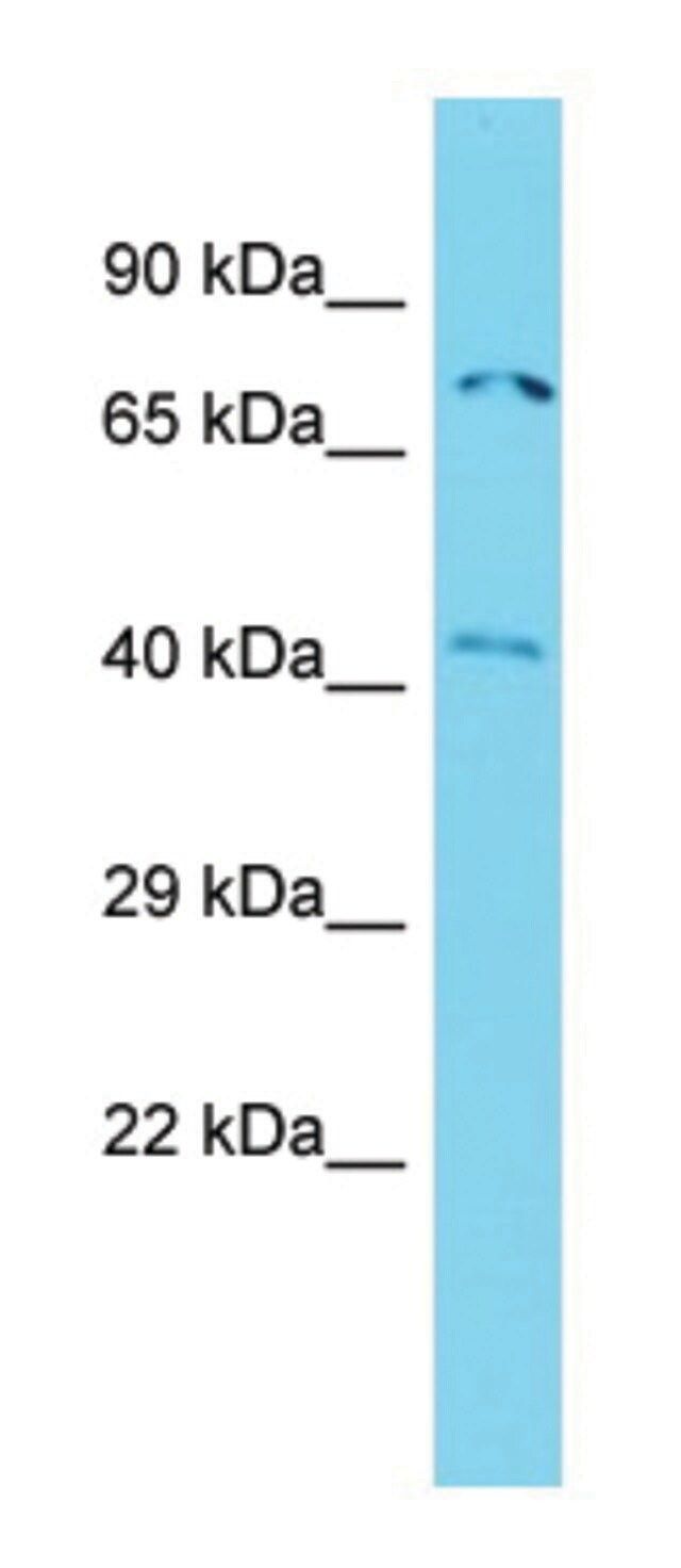 Anti-ACTR8 (N-terminal) antibody produced in rabbit