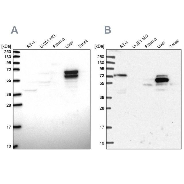 Anti-ACSS3 antibody produced in rabbit