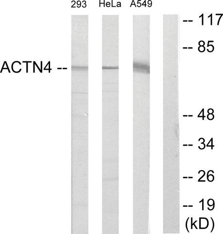 Anti-ACTN1 antibody produced in rabbit