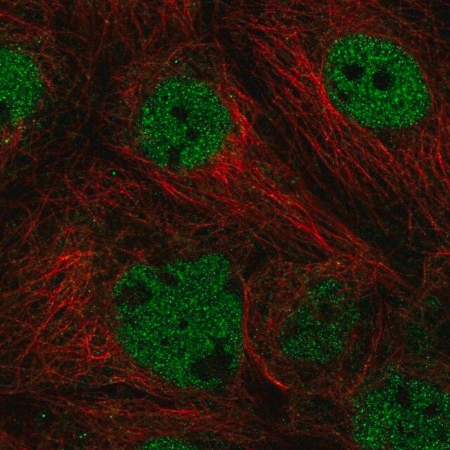 Anti-ACTL6A antibody produced in rabbit