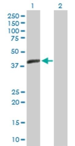 Anti-ACTL7B antibody produced in mouse