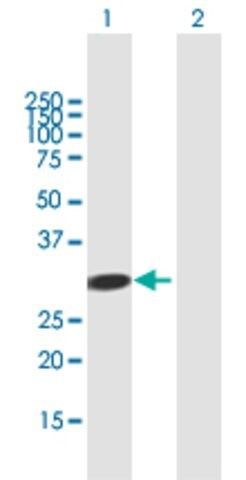 Anti-ADAL antibody produced in mouse