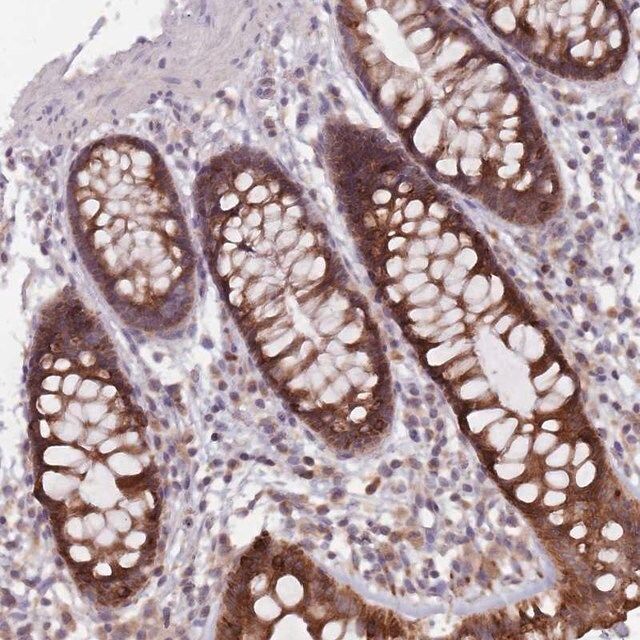 Anti-ADAL antibody produced in rabbit