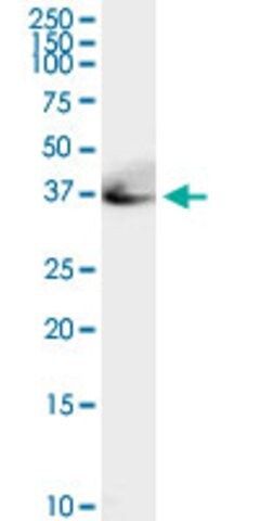 Anti-ADA antibody produced in rabbit