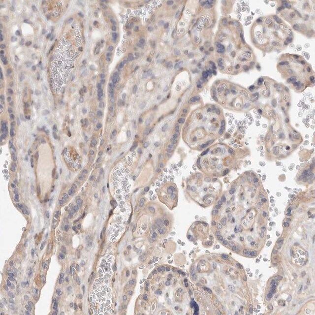 Anti-ADAMTS9 antibody produced in rabbit