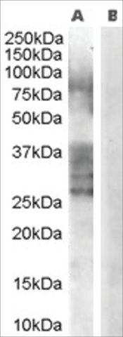 Anti-ADAM33 antibody produced in goat