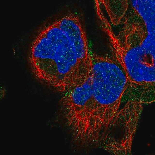 Anti-ADAM22 antibody produced in rabbit