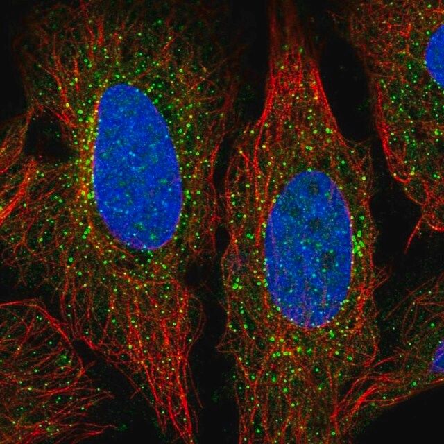 Anti-ADAMTS7 antibody produced in rabbit