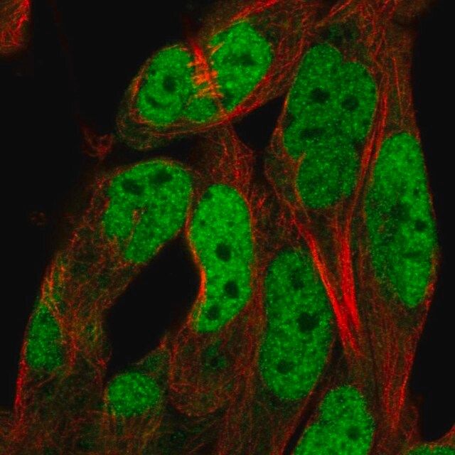 Anti-ADAMTS5 antibody produced in rabbit