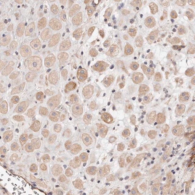 Anti-ADAMTS9 antibody produced in rabbit