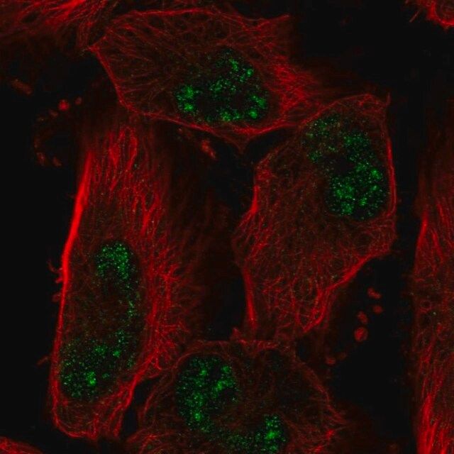 Anti-ADAMTS4 antibody produced in rabbit