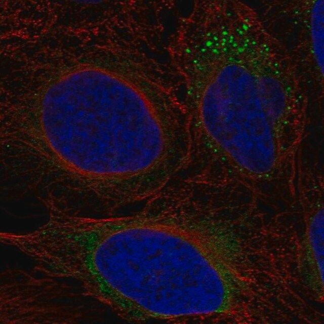 Anti-ADAMTS9 antibody produced in rabbit