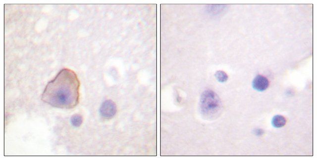 Anti-ADD1 antibody produced in rabbit