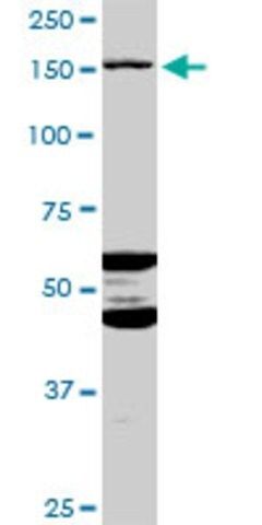 Anti-ABCC11 antibody produced in mouse