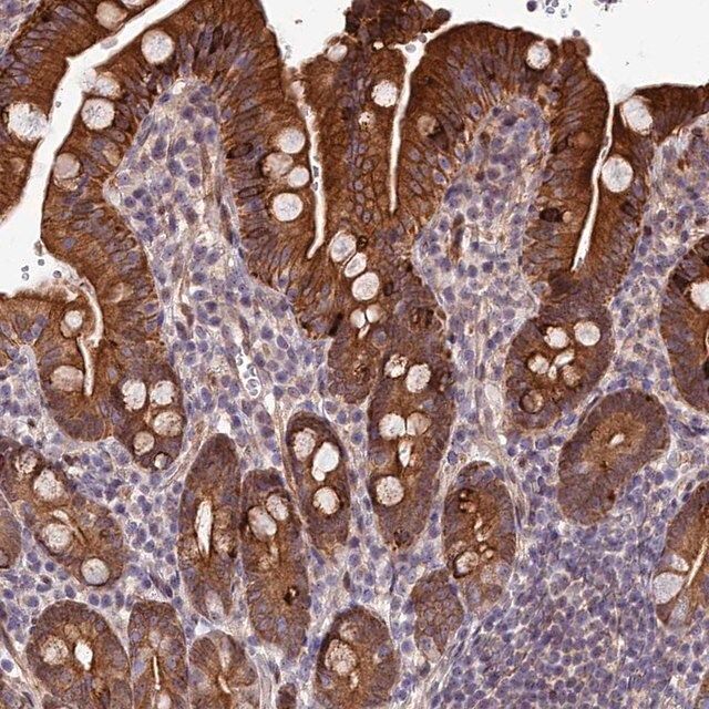 Anti-ABCB8 antibody produced in rabbit