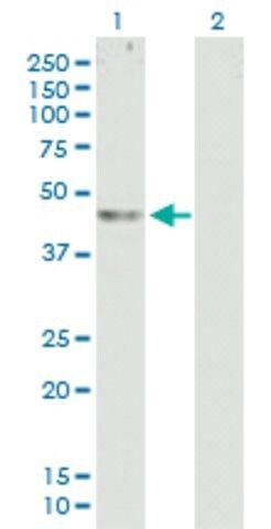 Anti-ABHD12 antibody produced in mouse