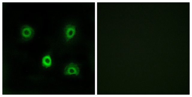 Anti-ABHD6 antibody produced in rabbit