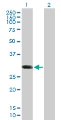 Anti-ABCC10 antibody produced in mouse