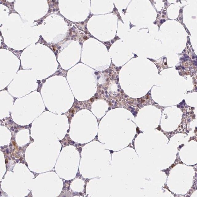 Anti-ABCB10 antibody produced in rabbit