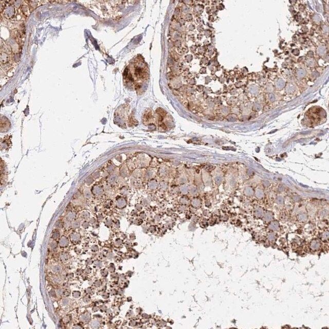 Anti-ABCB6 antibody produced in rabbit