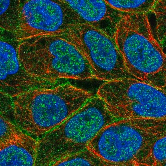 Anti-ABCC5 antibody produced in rabbit