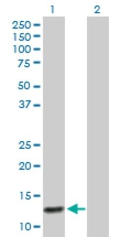 Anti-ABCC6 antibody produced in mouse