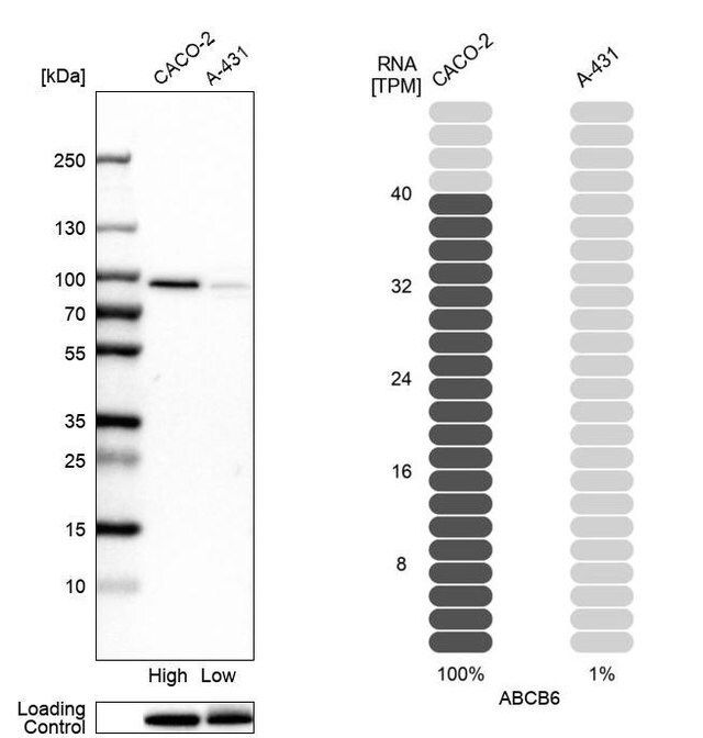 Anti-ABCB6 antibody produced in rabbit