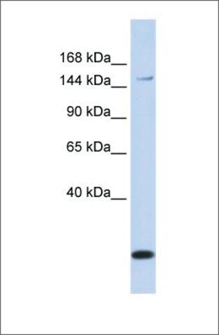 Anti-ABCC3