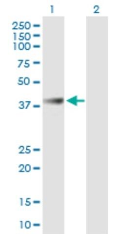 Anti-ABHD1 antibody produced in mouse