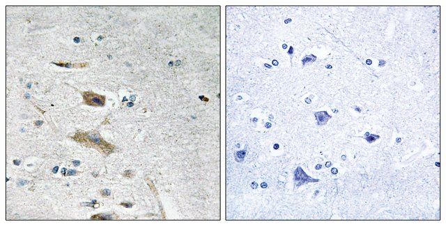 Anti-ABHD4 antibody produced in rabbit